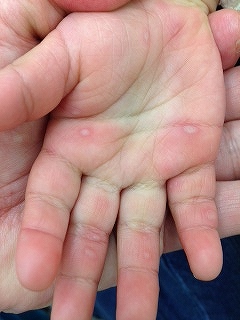 teashikutitenohira27