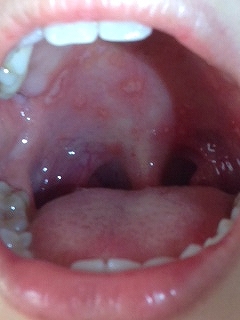 teasikutikutinonaka3