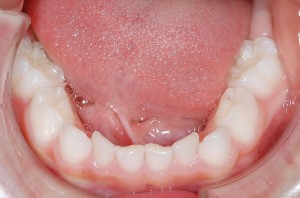 13ddef6b75dbd78341d58c5b009e3c65-e1427869323666